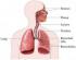 Hipertensión pulmonar primaria. Imagen Hipertensión pulmonar primaria. Imagen